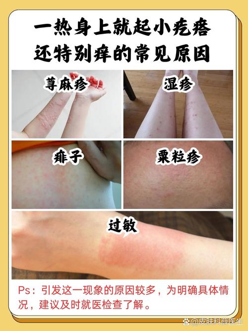 皮肤过敏反复发作,究竟为何?