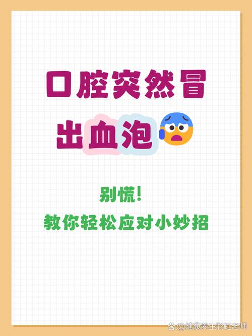 口腔血泡破了会怎样?需立即处理吗?