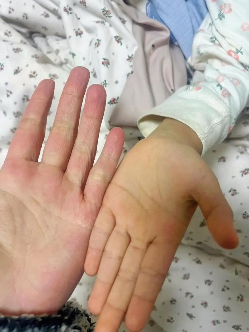 孩子皮肤发黄是何原因?