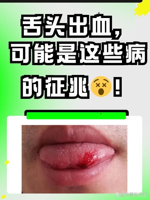 晚上睡觉口腔为何有血?
