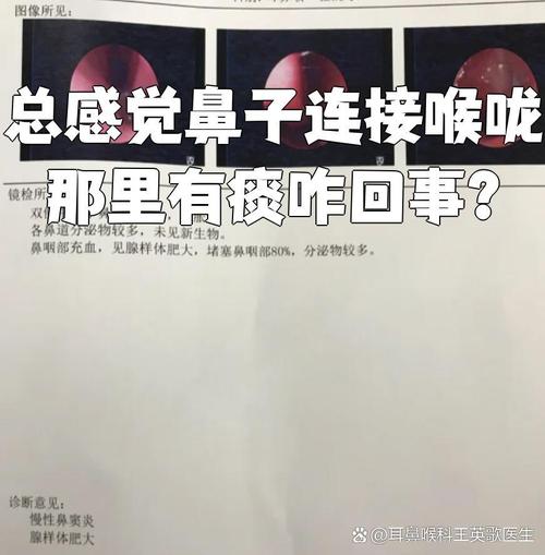 鼻腔口腔连接处异物如何处理?