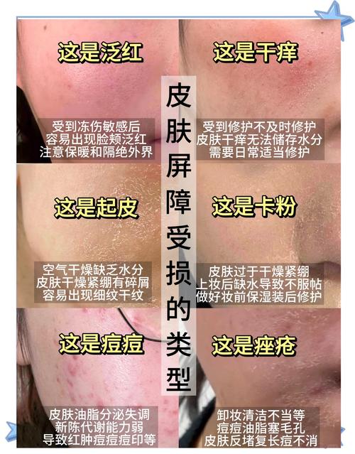 产后皮肤干燥脱皮如何快速修复?