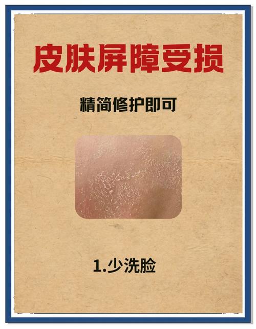 男生皮肤干燥起皮怎么快速解决?