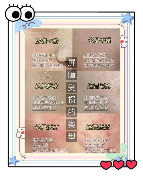 男生皮肤干燥起皮怎么快速解决?