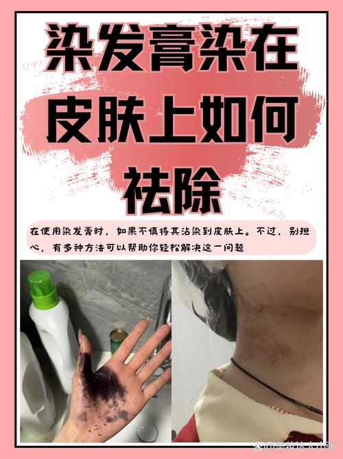 染发膏沾皮肤怎么快速洗掉?