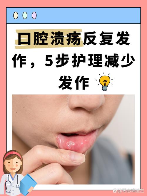 口腔溃疡发烧是关联还是巧合?