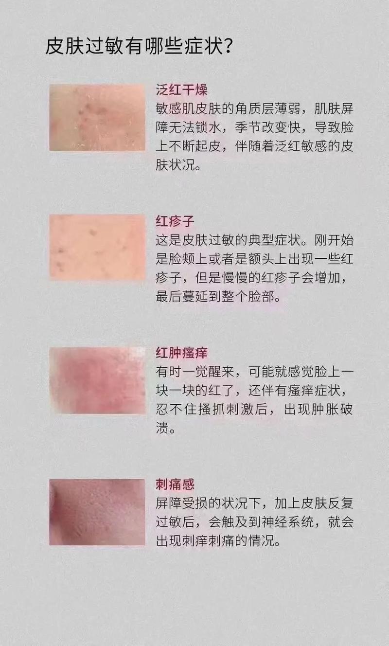 皮肤瘙痒红肿是过敏还是其他问题?