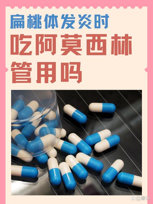 小儿扁桃体发炎吃什么食物最合适?