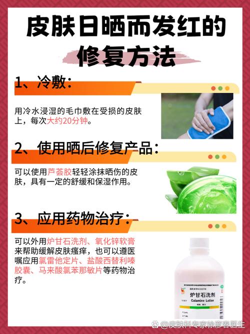 晒伤后红痛痒,如何快速缓解修复?