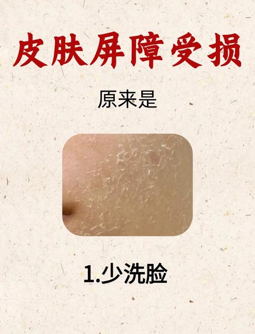 孕妇皮肤干燥起皮怎么办?