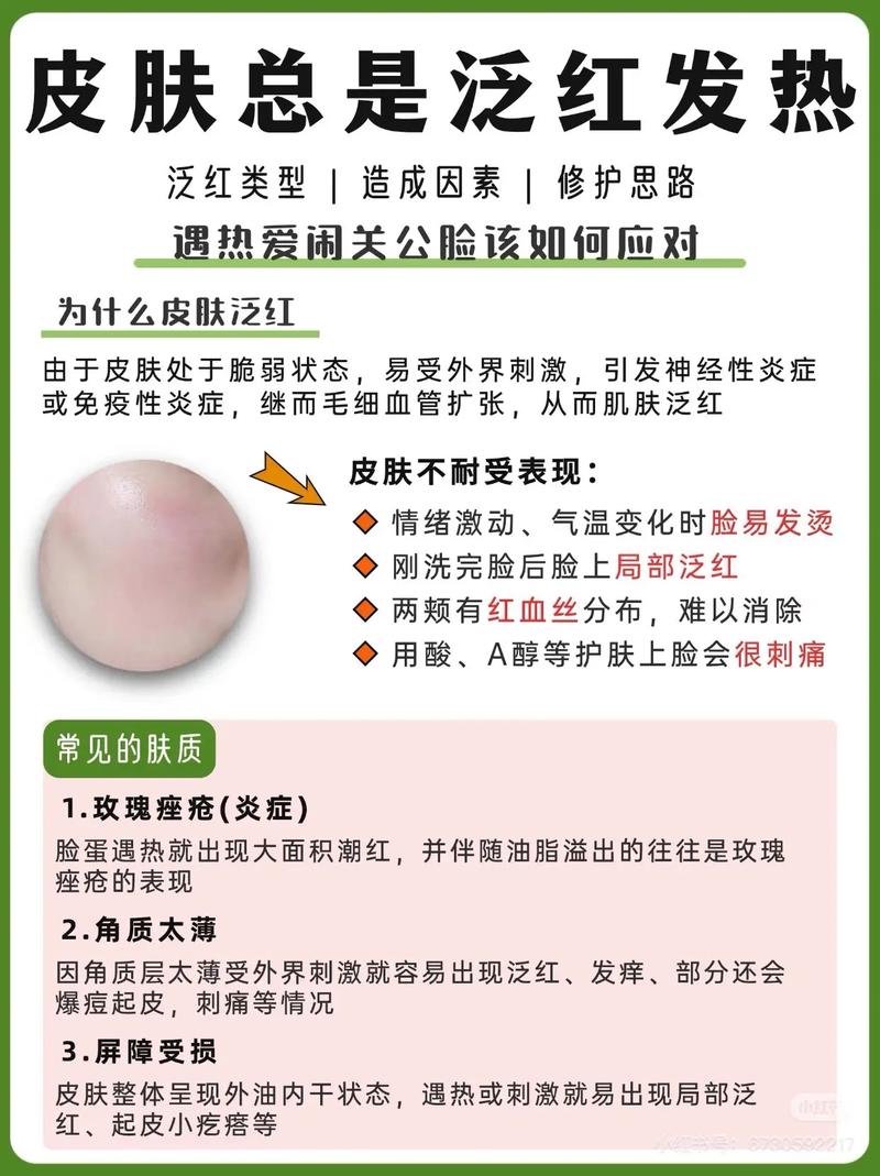 皮肤发热发红是过敏还是炎症?