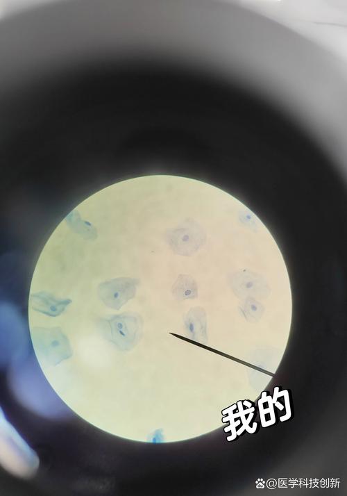 口腔上皮细胞用什么染色?