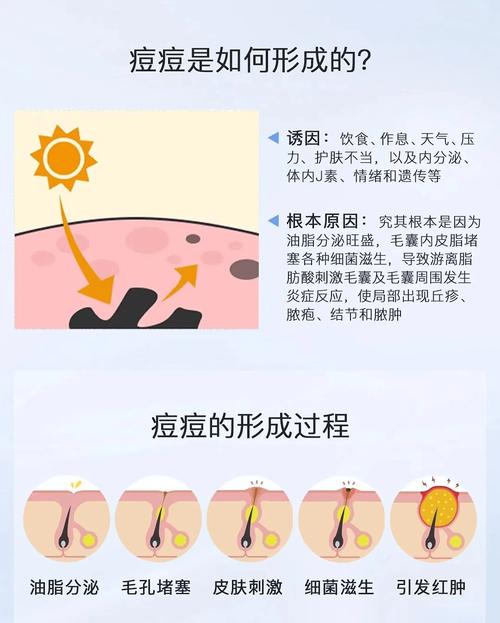皮肤油脂旺盛怎么控?