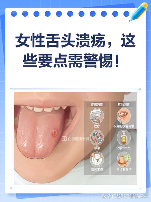 口腔溃疡真是上火引起的吗?