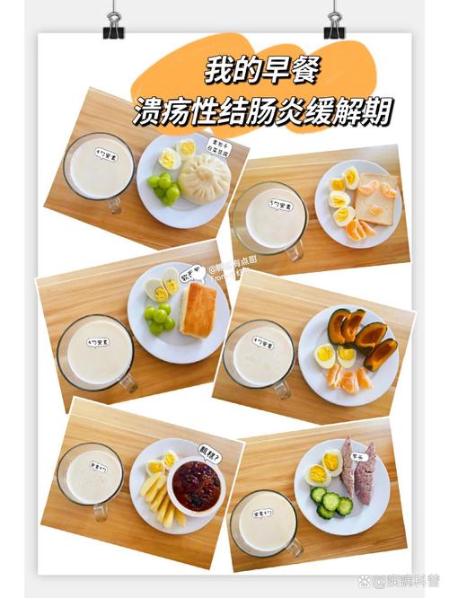 溃疡性结肠炎患者吃什么食物最合适?