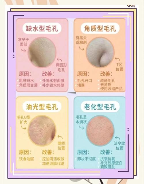 皮肤出油毛孔粗大,怎么有效改善?