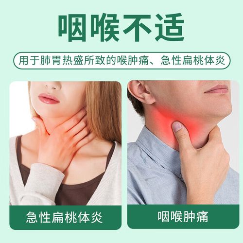 口腔溃疡能喝板蓝根吗?