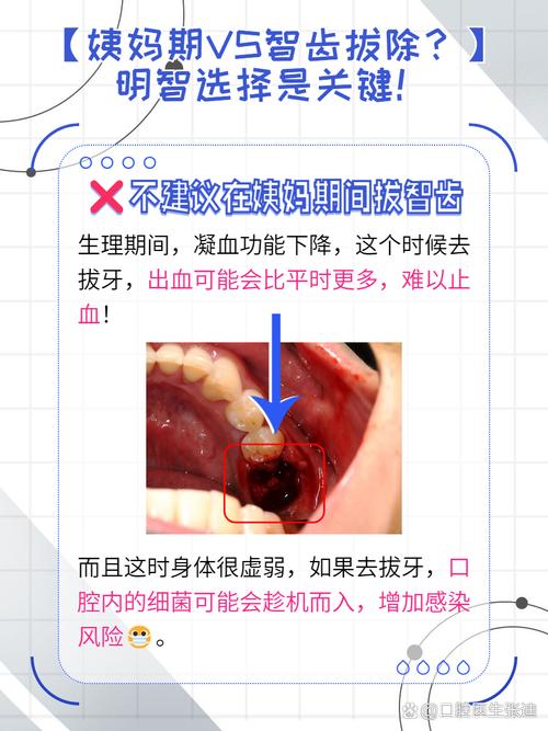 智齿磨口腔内壁,疼怎么办?