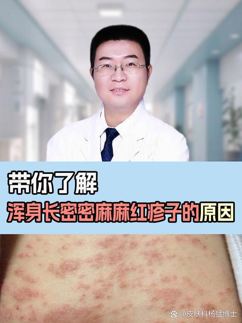 皮肤起红疙瘩是过敏还是其他问题?
