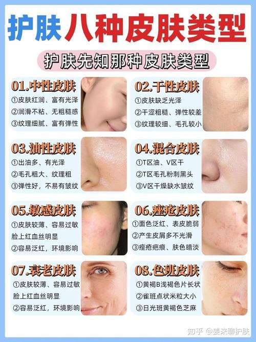 皮肤干燥是缺哪种维生素?