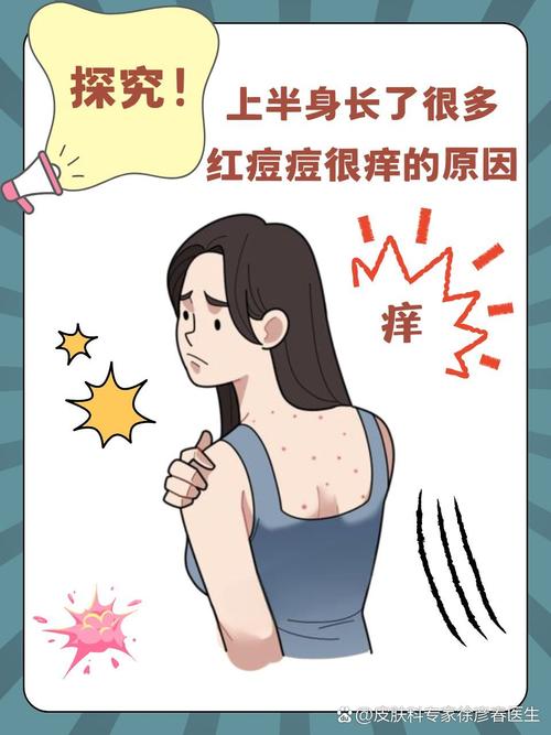 皮肤发辣是啥原因引起的?