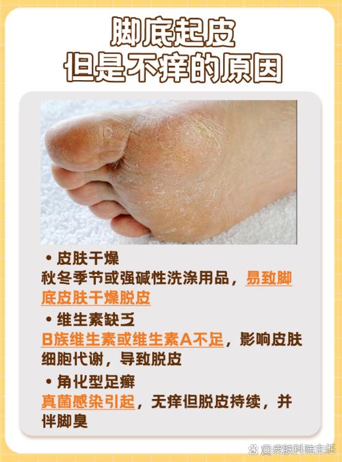 皮肤干燥脱皮,是缺水还是生病了?