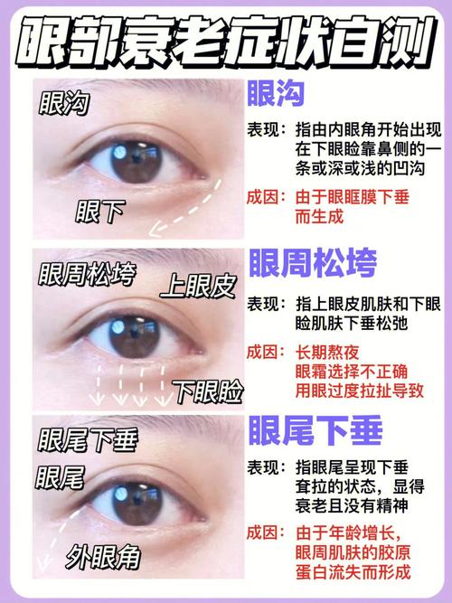 眼睛松弛怎么办?