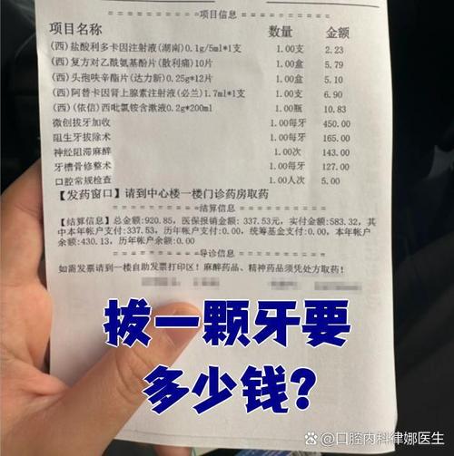 拔一颗牙到底要花多少钱?