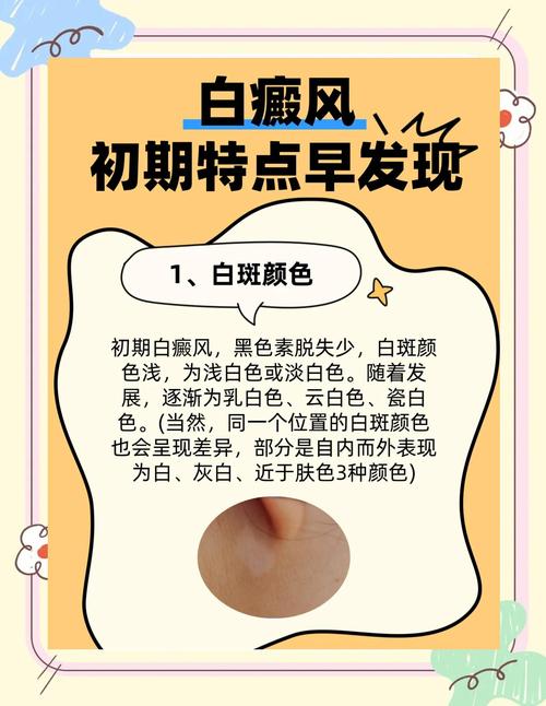 皮肤白一块一块是什么原因?