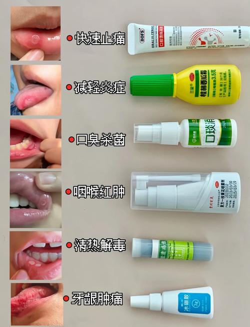 牙龈肿痛口腔溃疡怎么快速缓解?