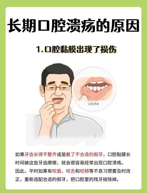 反复口腔溃疡为何总找上门?