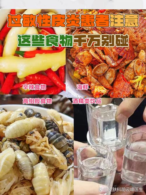 易过敏食物有哪些?30字疑问标题