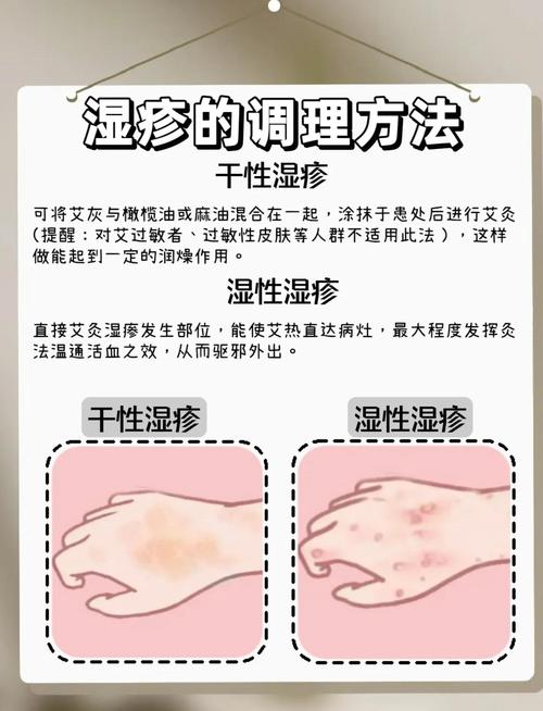 洗澡后皮肤痒,是过敏还是清洁过度?