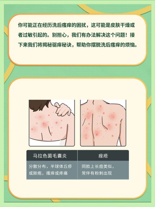 洗澡后皮肤痒,是过敏还是清洁过度?