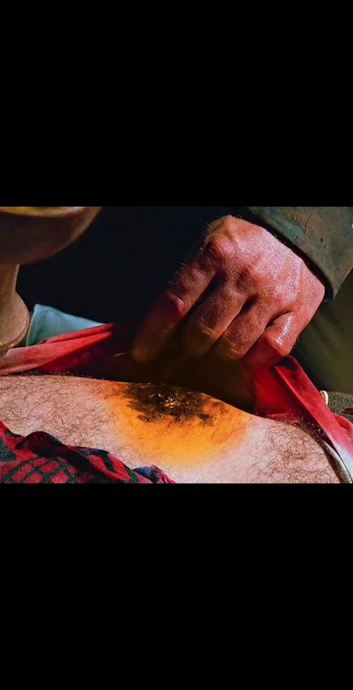 硫酸溅到皮肤上如何处理