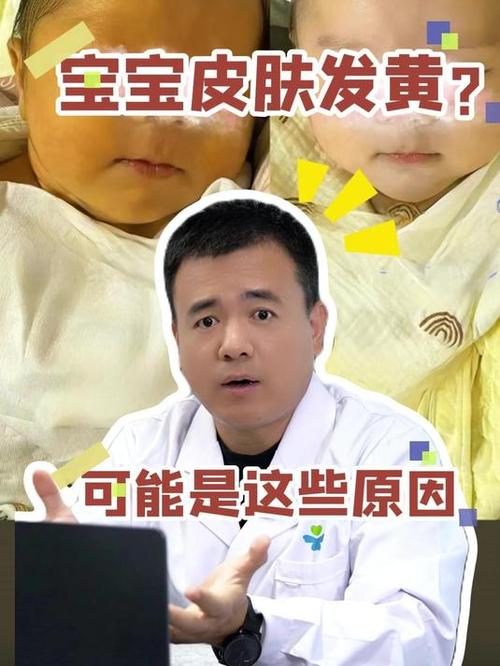 1岁宝宝皮肤黄怎么调理