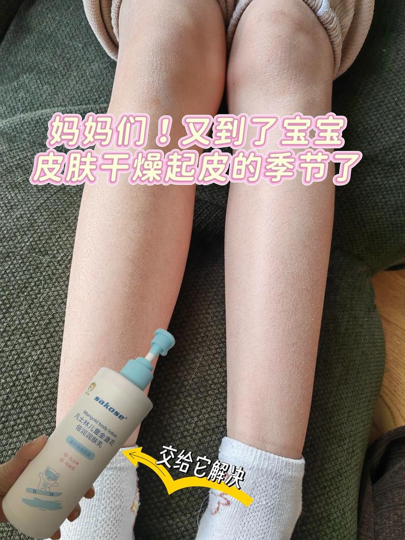 产后皮肤粗糙干燥怎么办