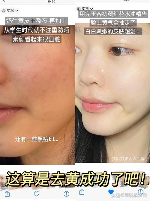 不用护肤品皮肤真的会更好吗?