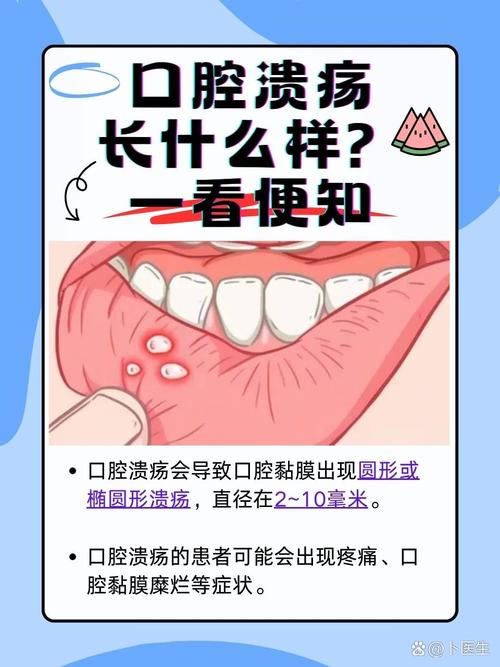 反复口腔溃疡,究竟是什么原因在作祟?