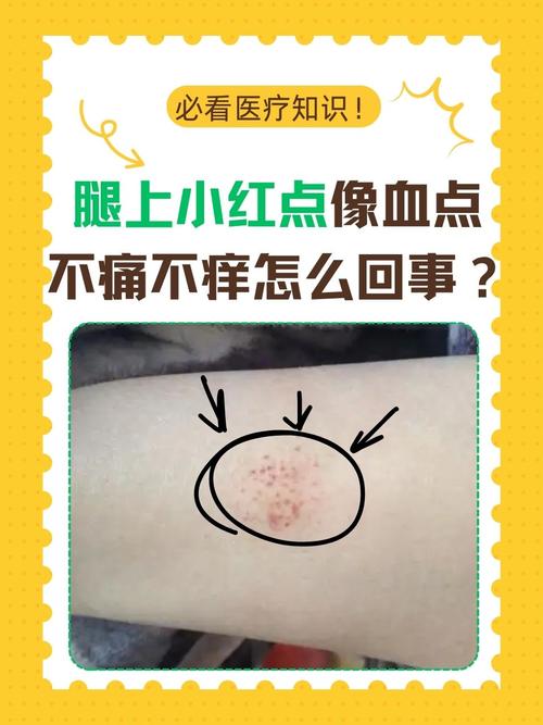 皮肤上不痛不痒小红点是何原因?