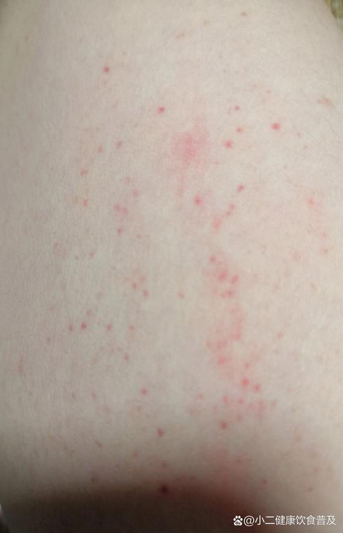 皮肤上不痛不痒小红点是何原因?