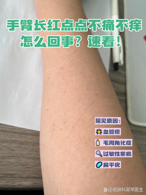 皮肤上不痛不痒小红点是何原因?