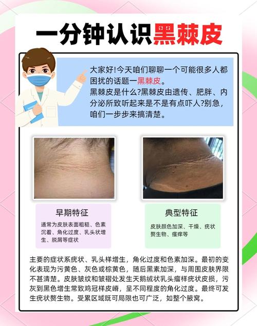 皮肤变黑是身体发出的什么信号?