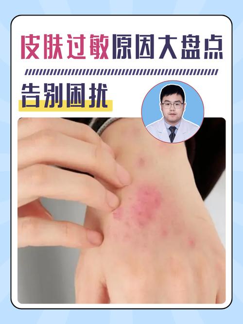 皮肤易过敏,究竟是何原因在作祟?