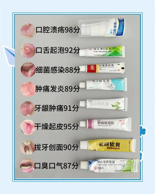 口腔溃疡能吃消炎药吗?