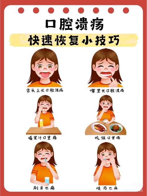 口腔溃疡痛难忍,咋快速止痛?