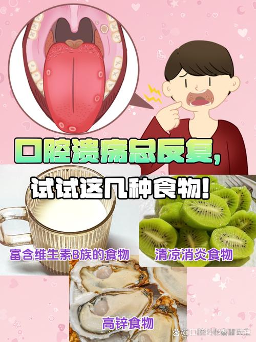 口腔溃疡该吃维生素B2还是B6?