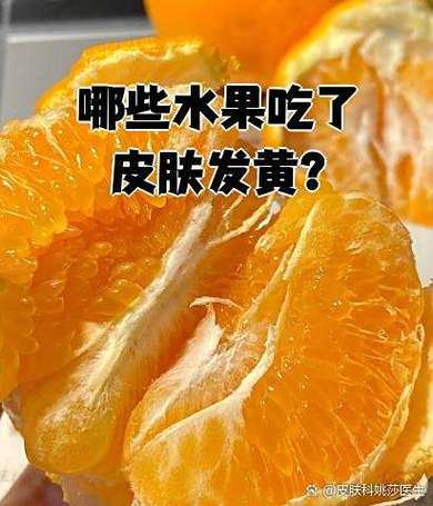 橙子吃多皮肤会变黄吗?