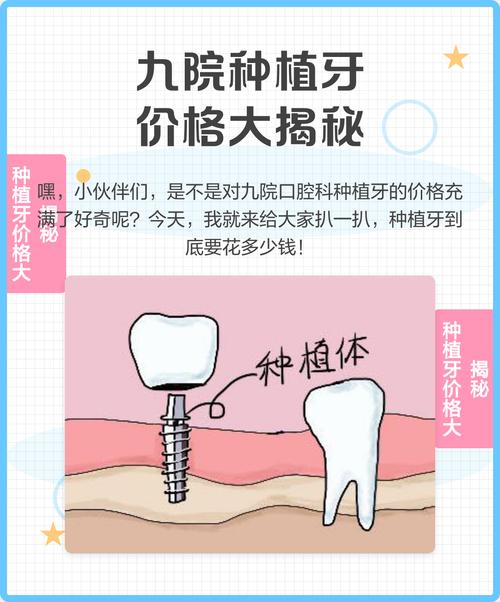 九院口腔科种植牙价目表包含哪些项目?