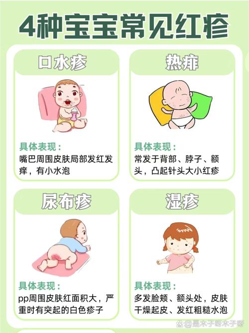 新生儿皮肤红是何原因?